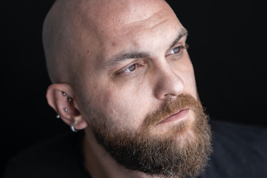 Baldness